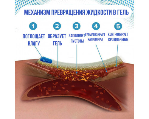 Гемостатический бинт с хитозаном